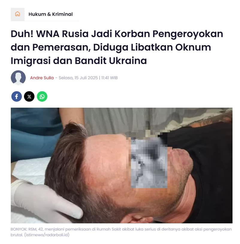 Screenshot from RadarBali – News article titled *"Russian Foreigner Victim of Robbery and Extortion, Allegedly Involved Immigration Officials and Ukrainian Bandits."
The image shows RSM, 42, receiving medical treatment after reportedly being assaulted by a group posing as immigration officers.